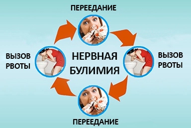 Лечение булимии в Новотроицке